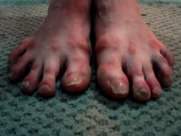 pies de musalva.jpg