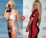 cola_Jenna-Jameson_booty-implants_www_antesydespues_com_ar.jpg